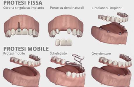 Cartuccia Per Materiale Di Impressione - Alibaba - Foto 6
