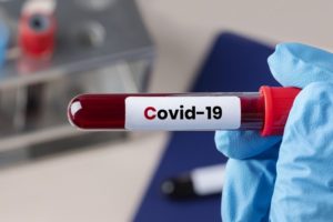 covid-19 test