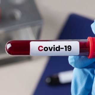 Come capire se si è positivi al covid-19: i diversi test disponibili